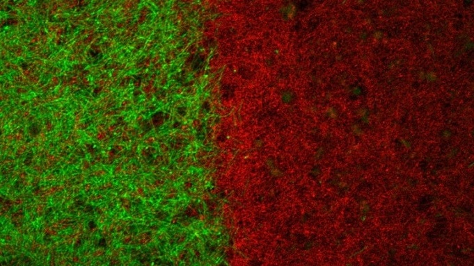 Microgels Let Medical Implants Fight Off Bacteria - Tech Briefs
