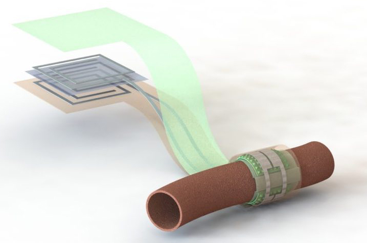 Diagram of Biodegradable Pressure Sensor.